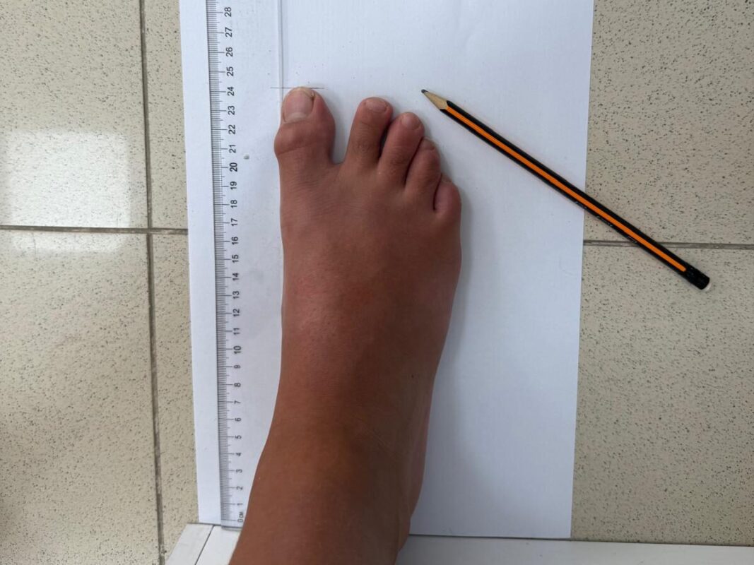 Cómo medir correctamente el pie de un niño para elegir la talla adecuada.